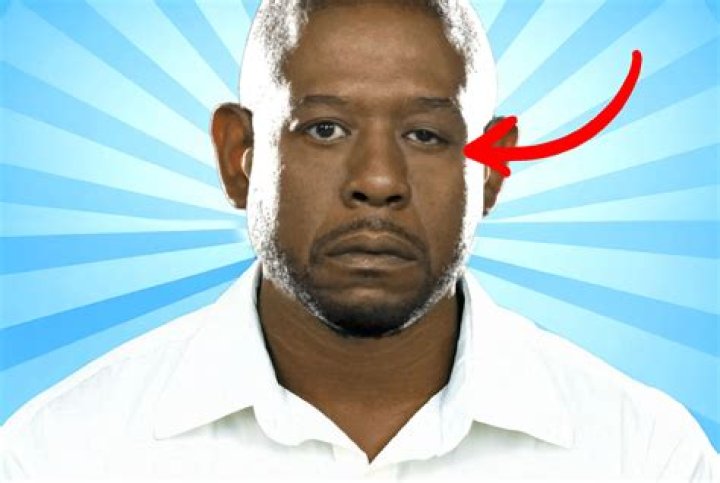Unveiling Forest Whitaker's Left Eye: A Unique Journey